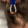 Tick Remover Tool — view 2