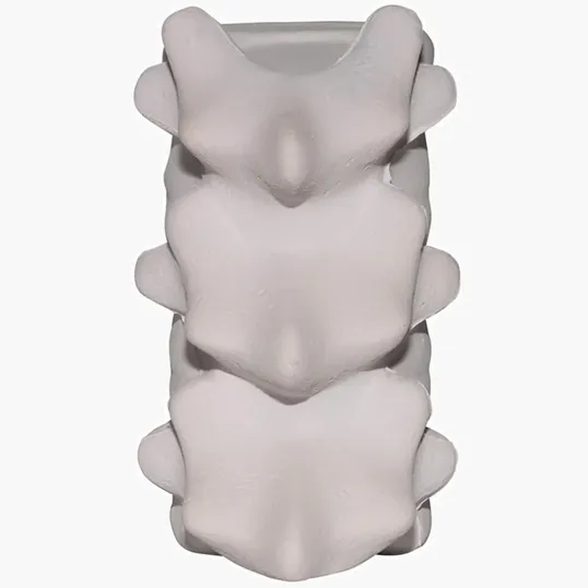 Spine Stress Reliever — view 3